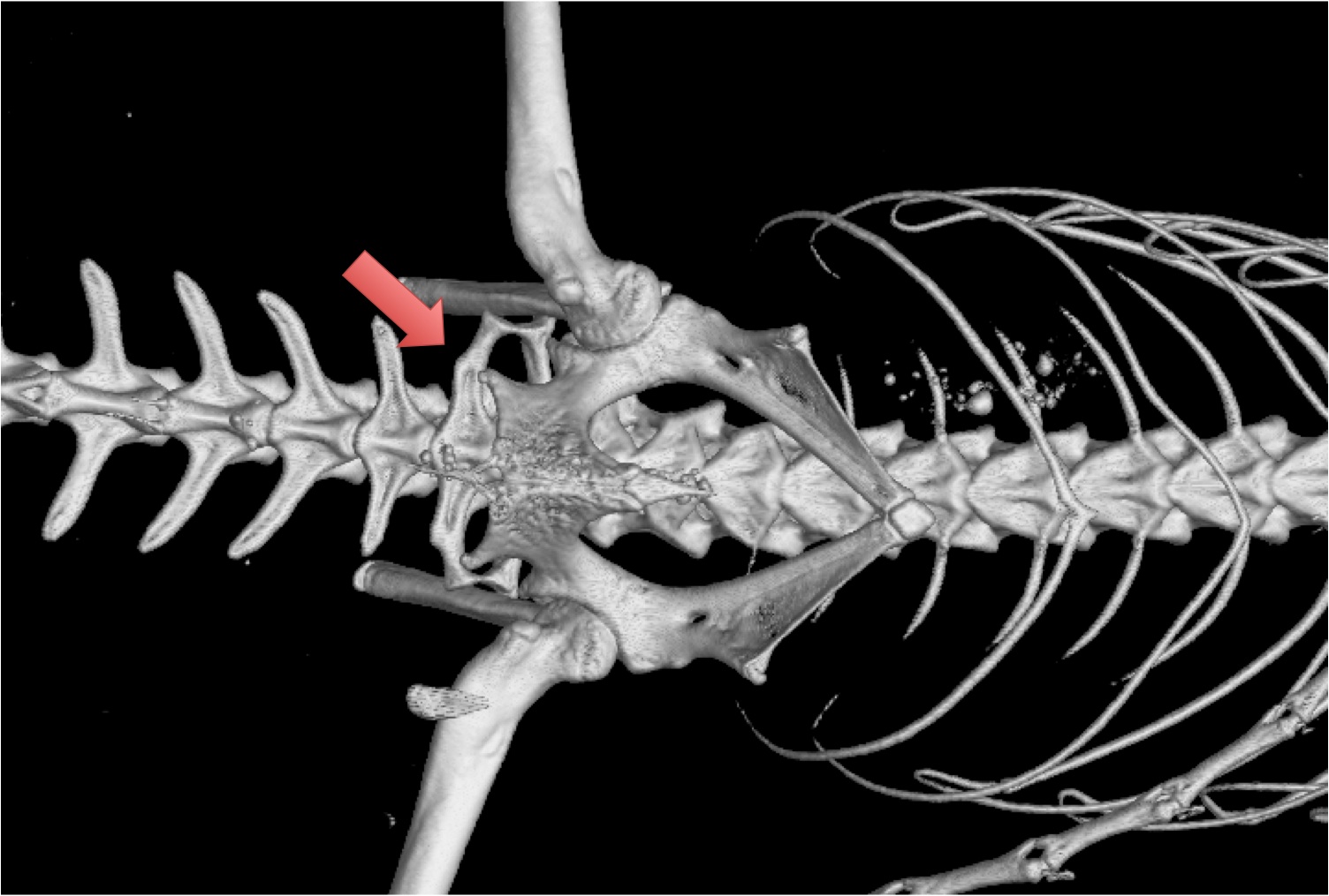 normal_sacrum.jpg